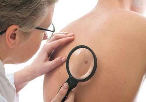 dermatologists in chandigarh